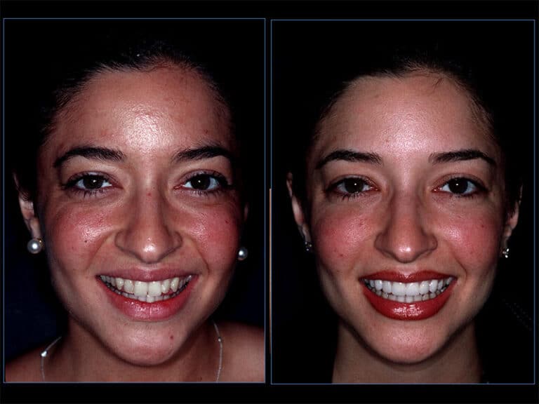 smile-gallery-pp-10