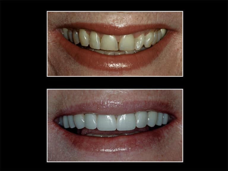 smile-gallery-pp-2