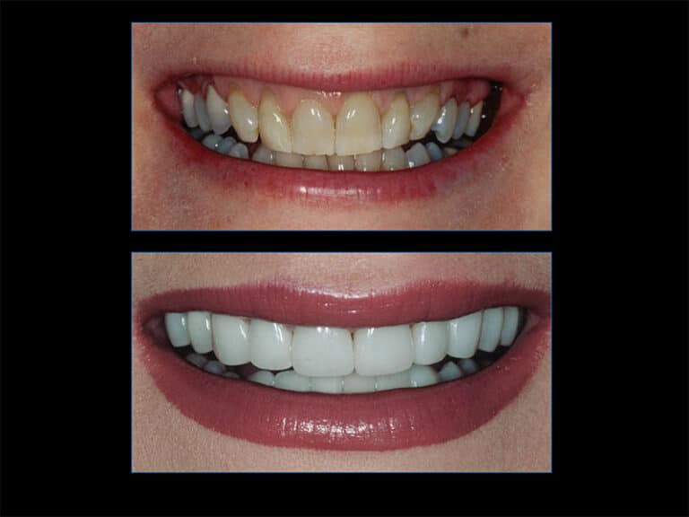 smile-gallery-pp-3