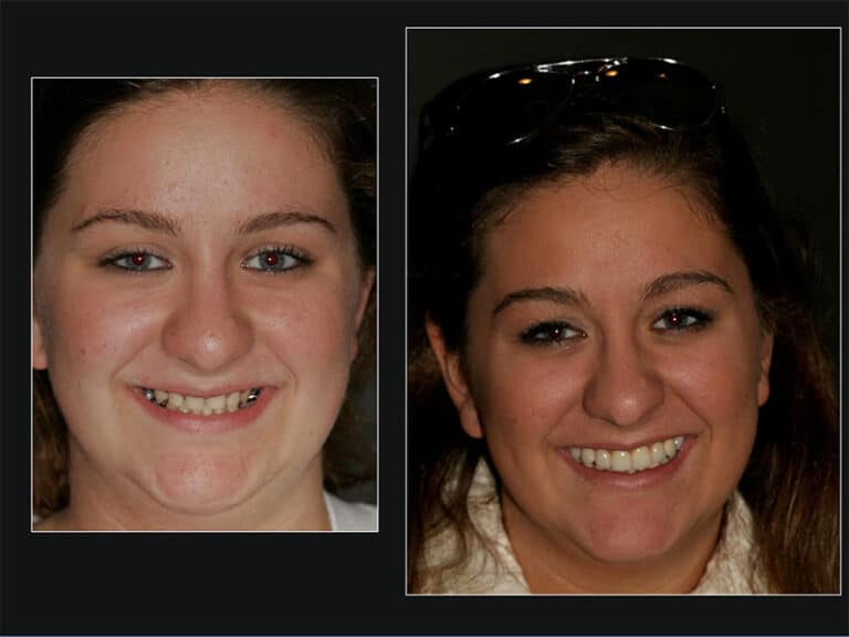 smile-gallery-pp-7