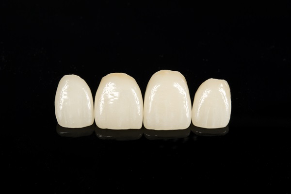 How Many Years Do Dental Crowns Last On Average?
