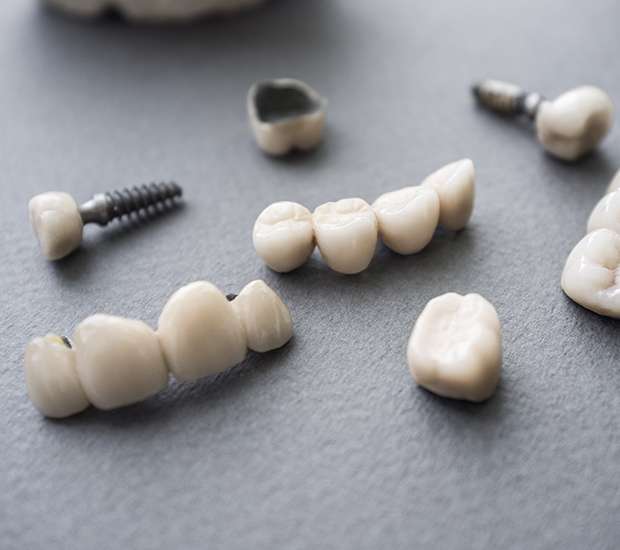 East Hanover The Difference Between Dental Implants and Mini Dental Implants